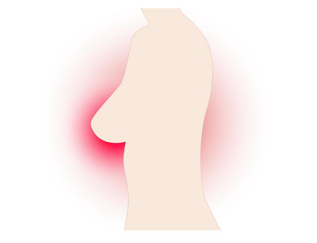 Zánět prsu po operaci: Jak předejít a léčit?