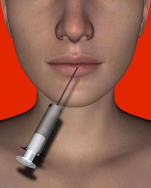 Botox: Jak probíhá zákrok krok za krokem?