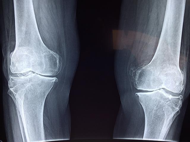 Prevence ‍opětovného ‌poranění kolene