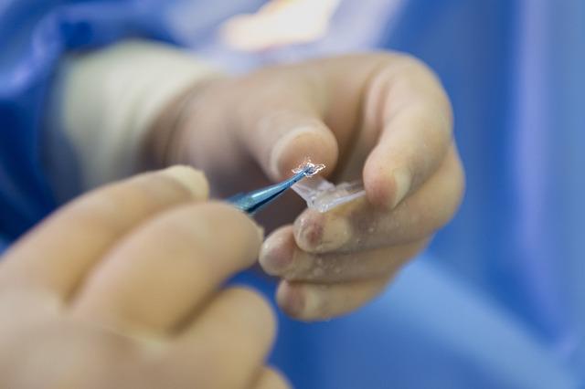 Jak řešit persistentní rozostřené vidění po laserové operaci očí