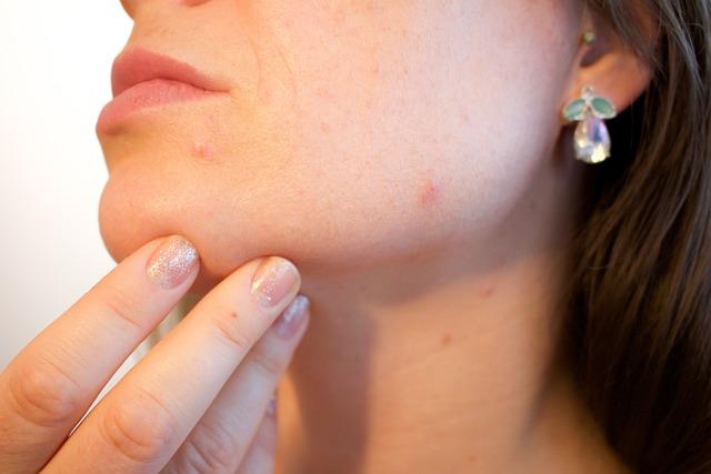 Důležitost konzultace s dermatologem před⁤ podstoupením chemického peelingu